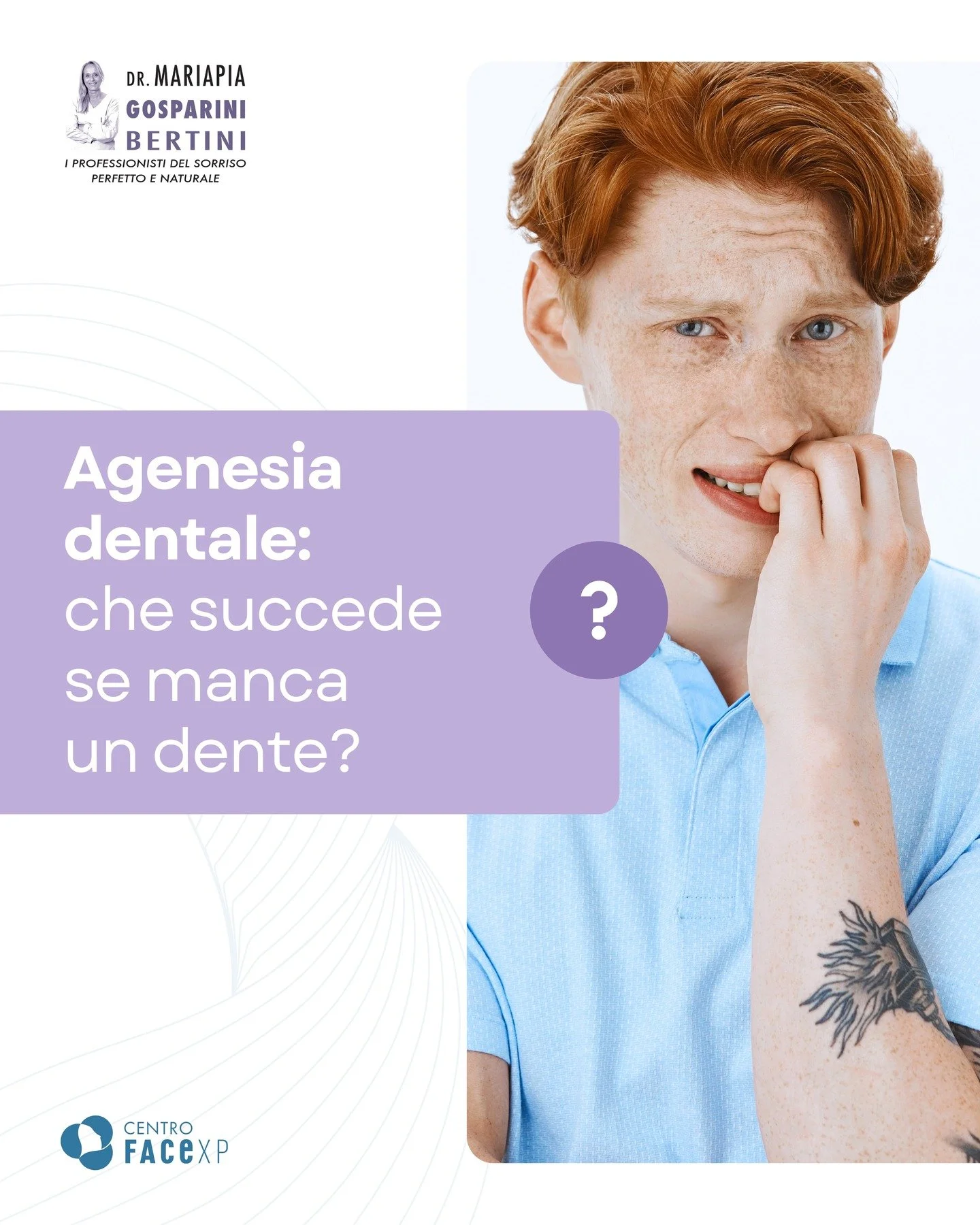 ❓ Sapevi che, in molti casi, lo spazio lasciato da un dente mancante pu&ograve; essere chiuso con l&rsquo;apparecchio?

➡️ L&rsquo;agenesia dentale &egrave; un&rsquo;anomalia dentaria caratterizzata dalla mancanza congenita di uno o pi&ugrave; denti: