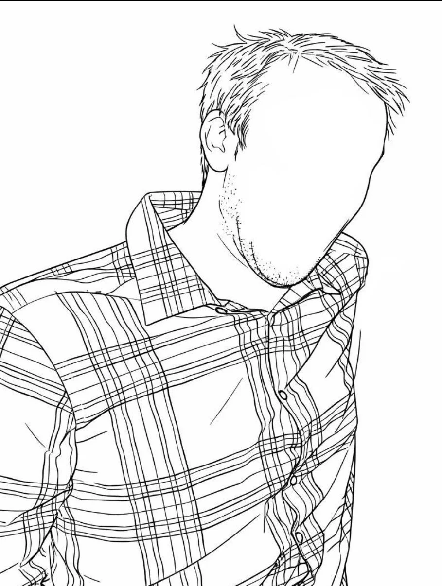 The Case of the Missing Hairline&nbsp;(Work in Progress)