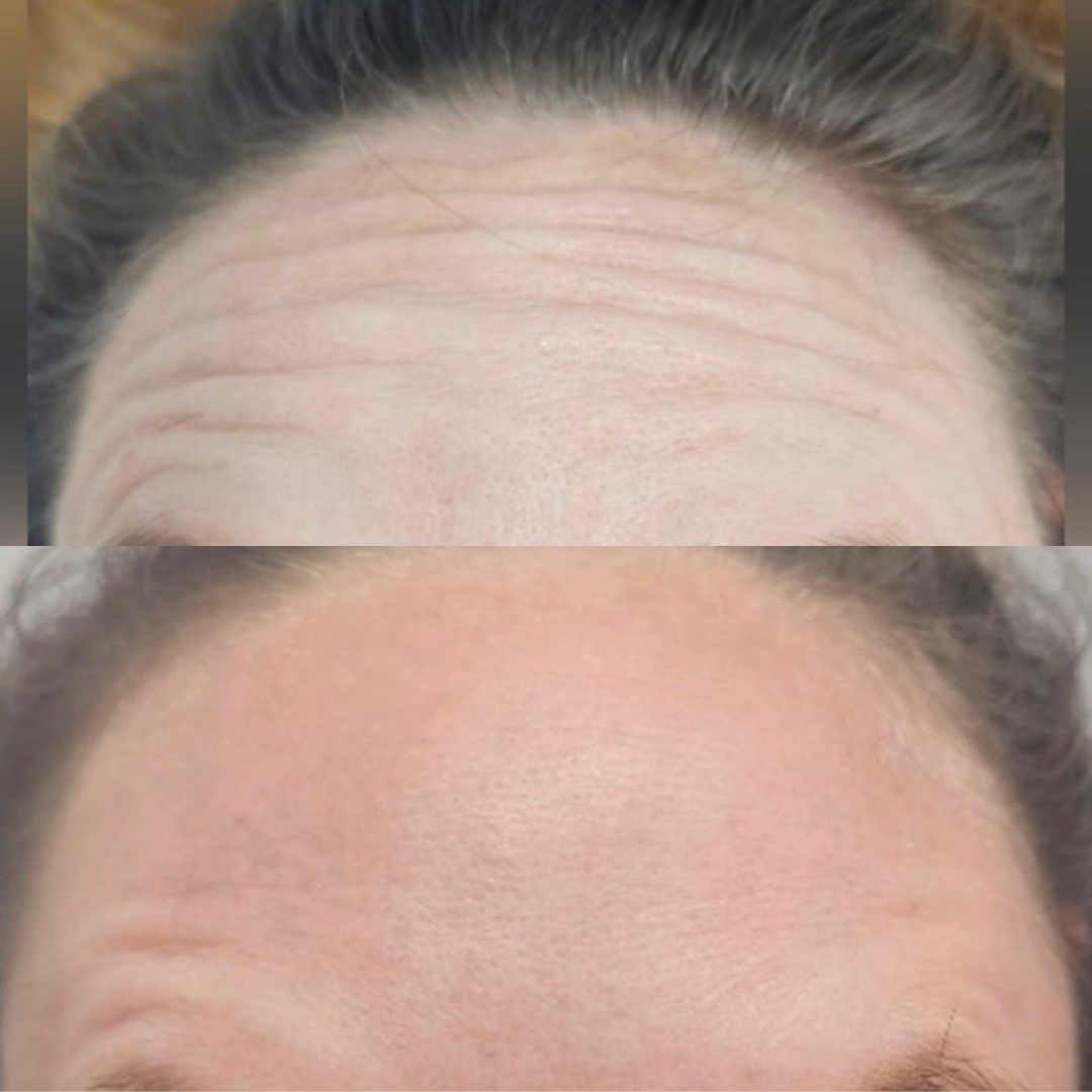 Copy of Marble Before And After Lash Tech Instagram Post.png