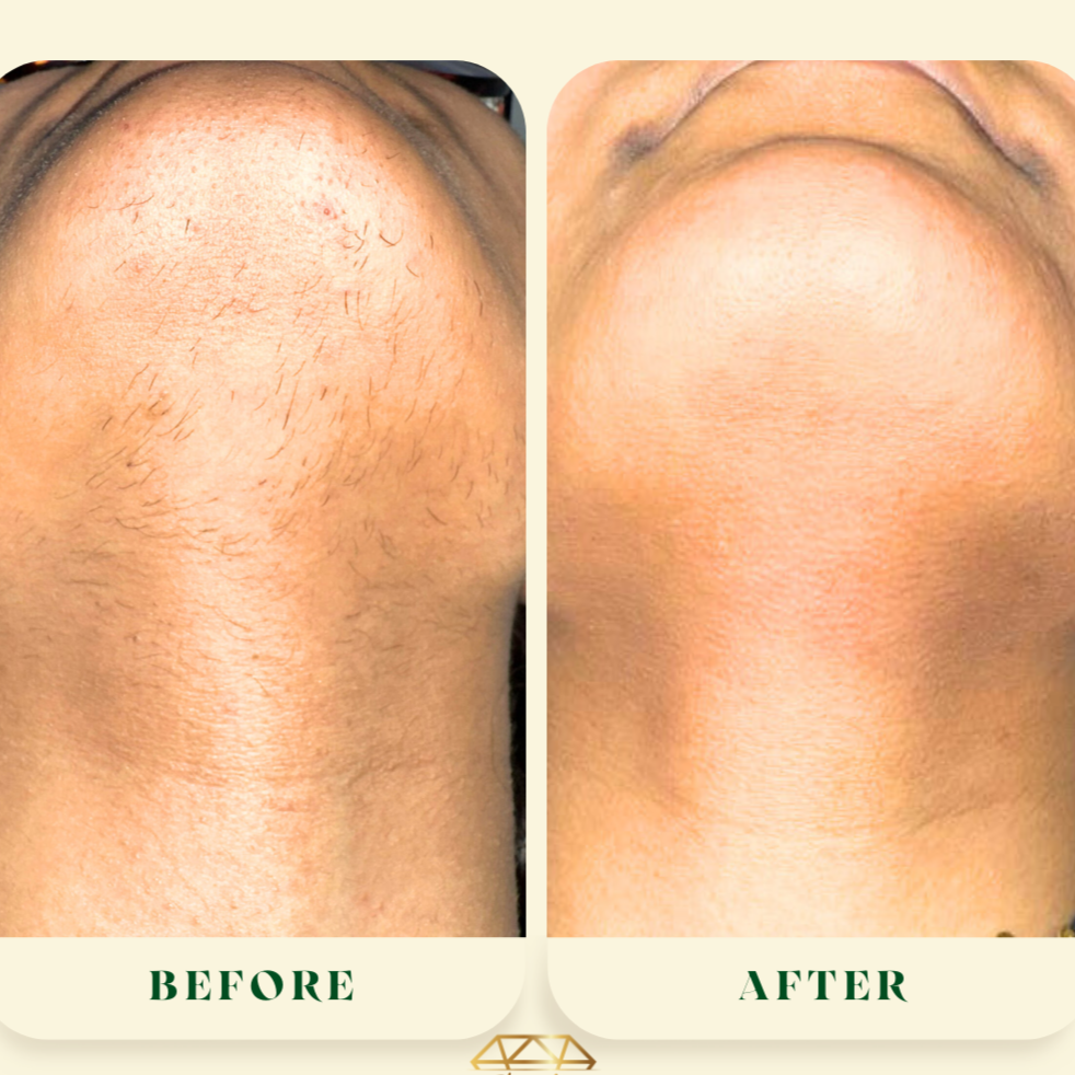 Minimalist+Before+After+Salon+%26+Makeup+Instagram+Post.png.png