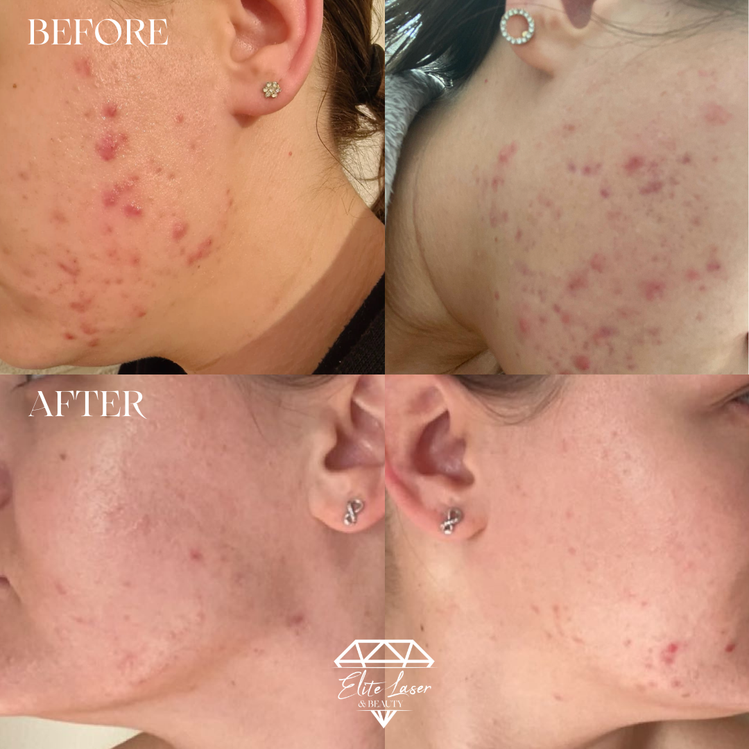 One Client, Three Treatments