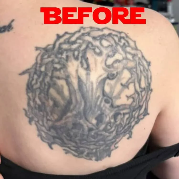 Tattoo of a tree with a lion's face in the center on a person's chest, with the word 'BEFORE' in red text at the top.