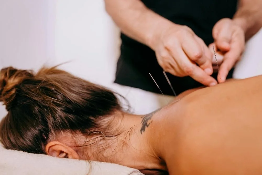 Person receiving acupuncture treatment on their back as an acupuncturist inserts fine needles.