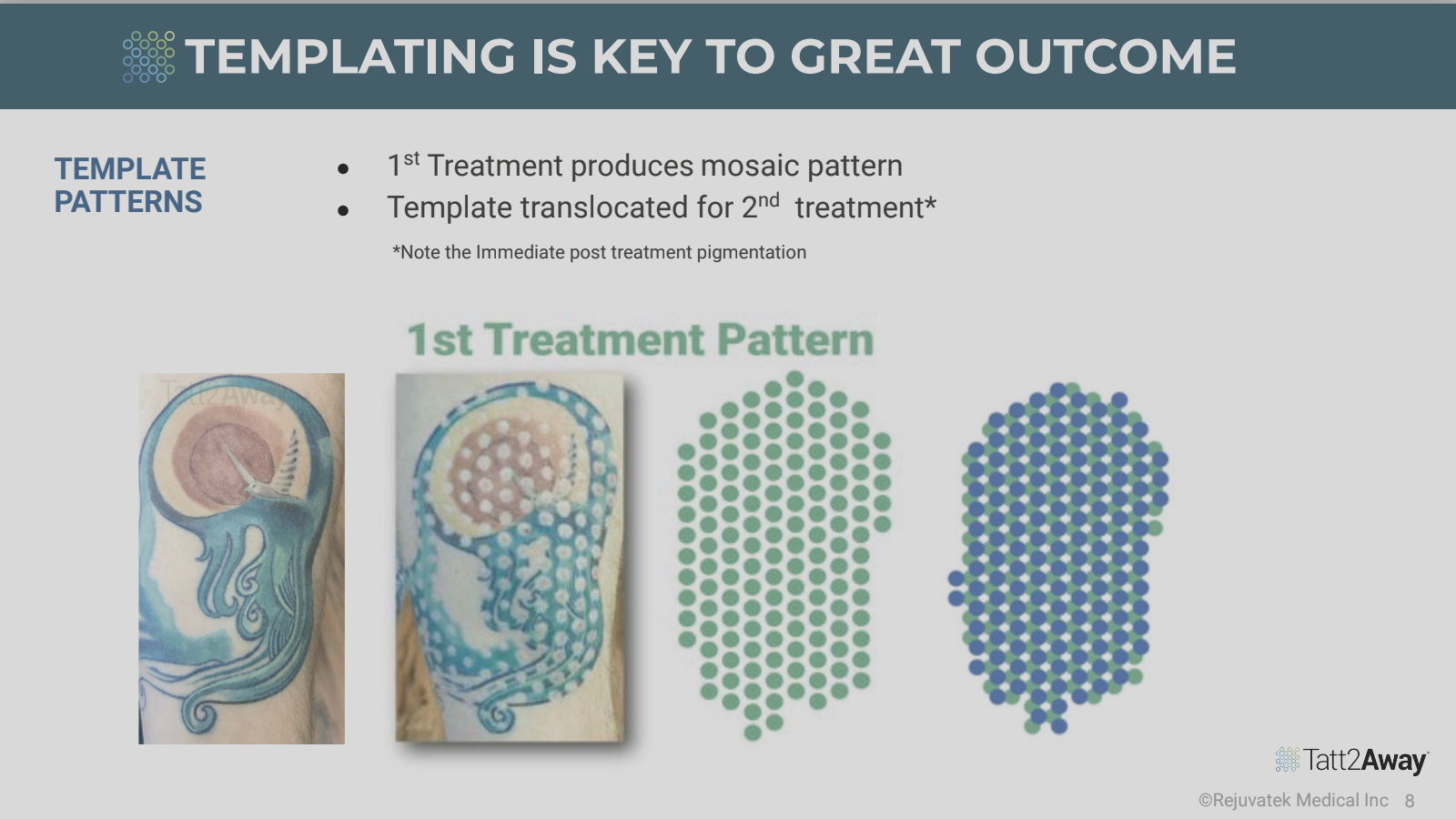 A presentation slide showing tattoo treatment patterns. The slide has a title 'TEMPLATING IS KEY TO GREAT OUTCOME,' and mentions that the first treatment produces a mosaic pattern which is then translocated for a second treatment. There are images of