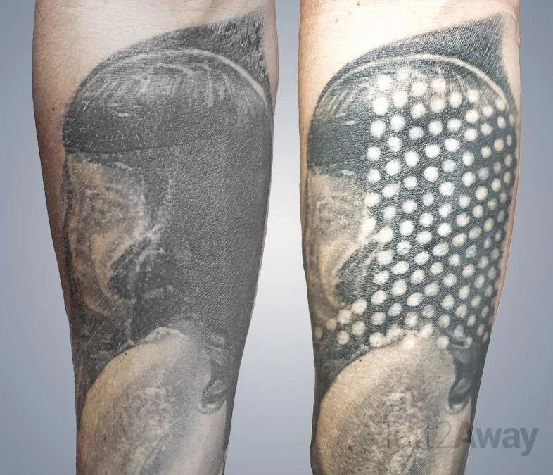 A tattoo on a person's forearm showing a woman's face and a pattern of white dots over her head, creating a visual effect.