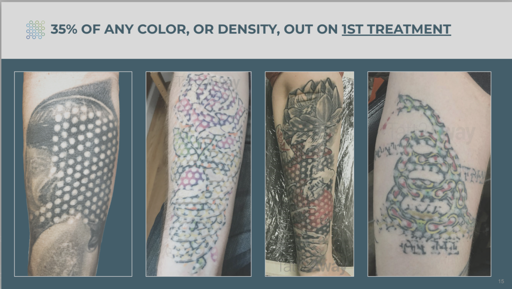 Presentation slide showing four different tattoos on arms. The first tattoo is a black and gray snake with a pattern of white dots. The second tattoo is colorful with a repeating pattern of pink, yellow, and green dots. The third tattoo features a de