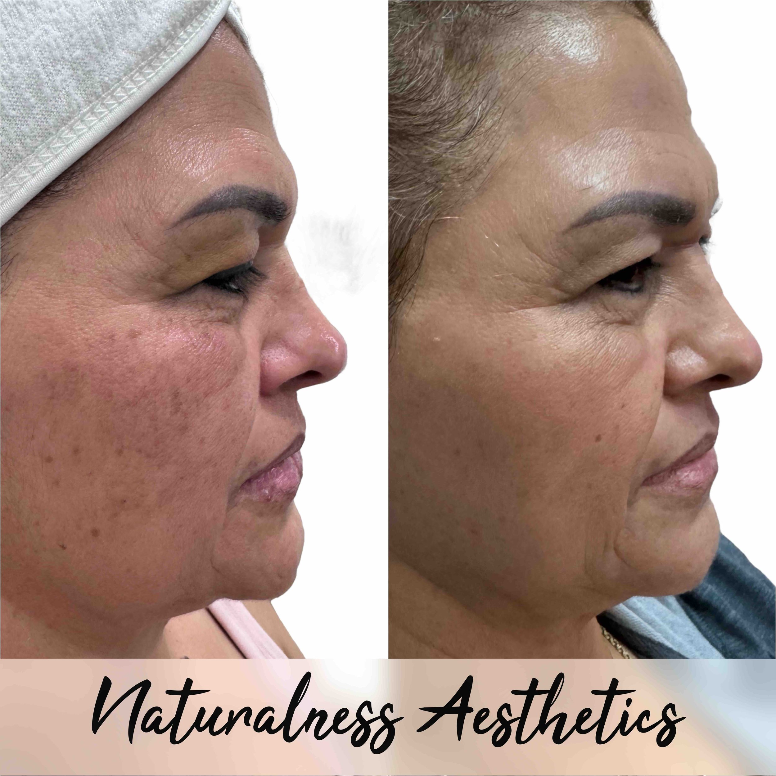 Naturalness Med Spa 07.jpeg