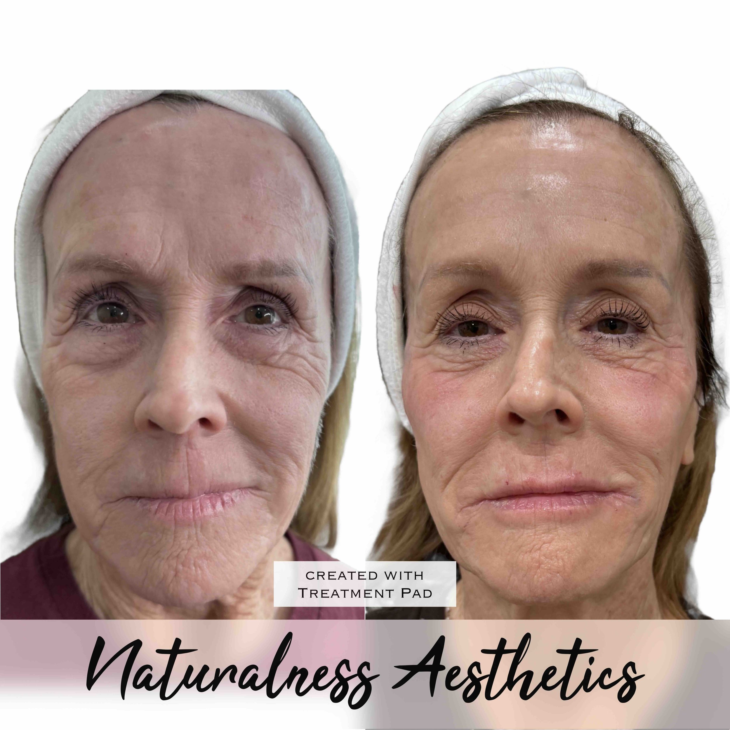 Naturalness Med Spa 09.jpeg