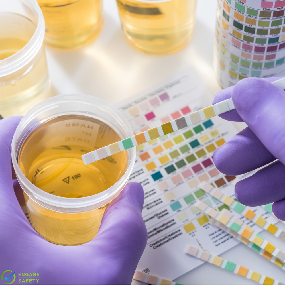 Drug Testing in Queenstown | Workplace Testing — Engage Safety