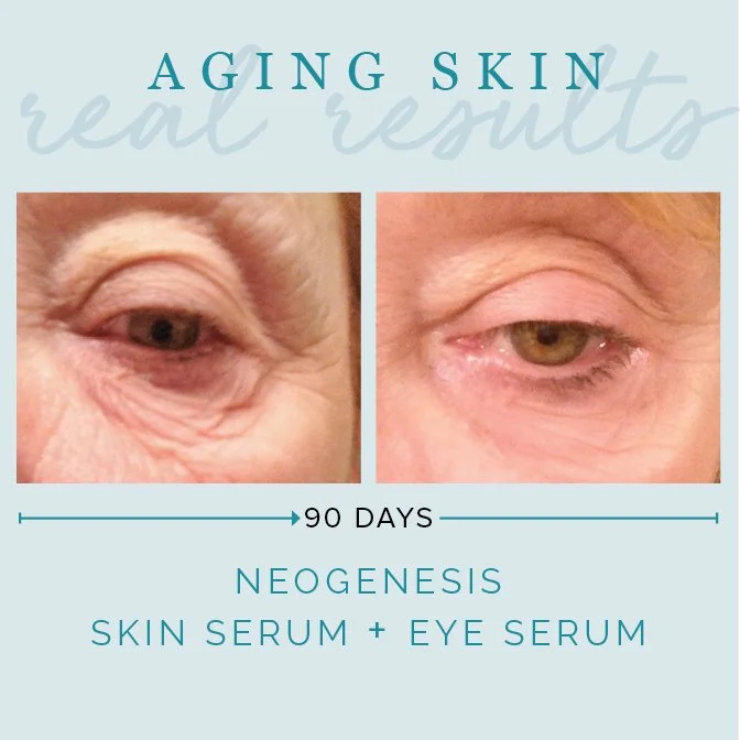 CB-BA_AgingSkin_RealResults.jpg