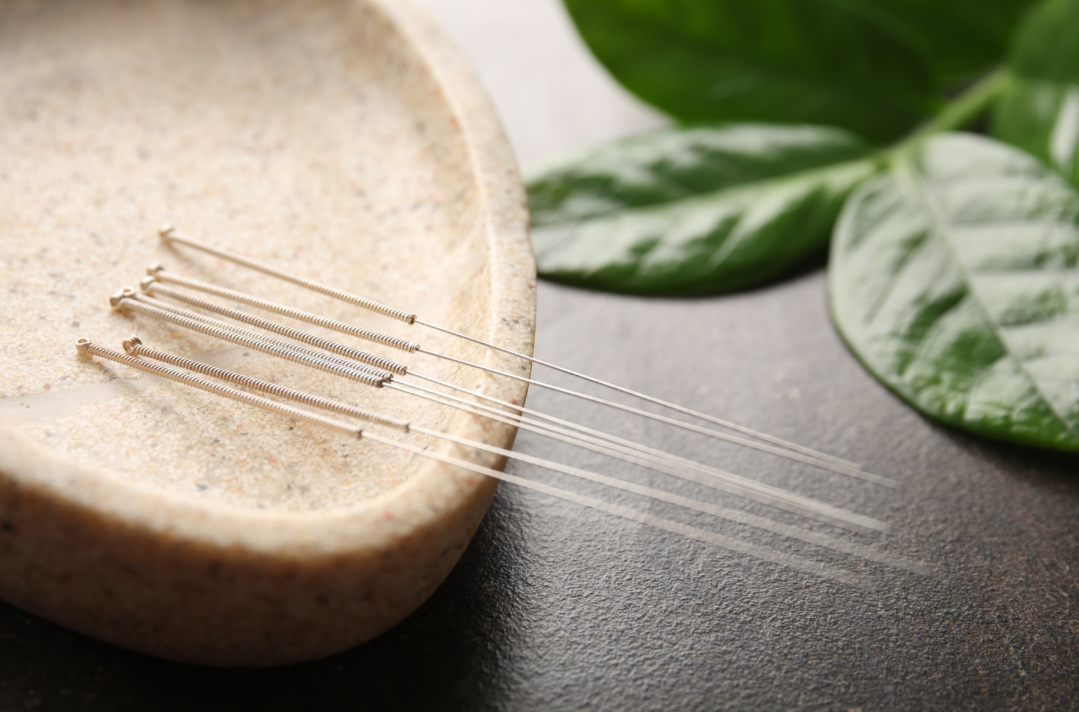 What Acupuncture &amp; TCM Actually Treat