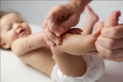 Acupuncture for Child Anxiety in Calgary — A Natural Approach That Works