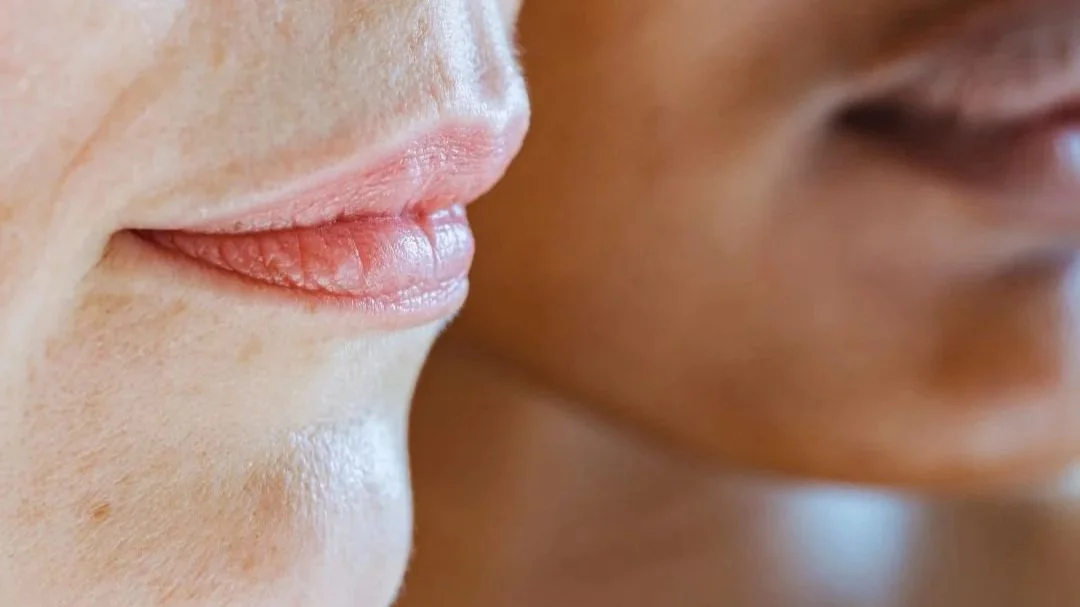 Acupuncture for Skin Conditions in Calgary