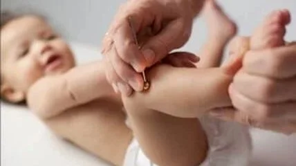 Child receiving non-needle acupuncture technique