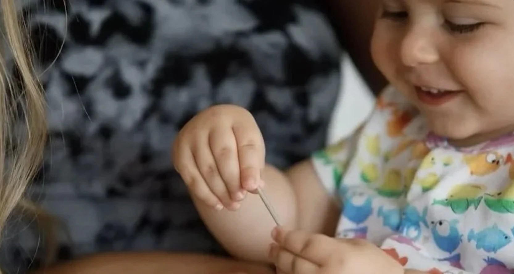 Child receives acupuncture by Dr. Joseph Coccagna in NW Calgary