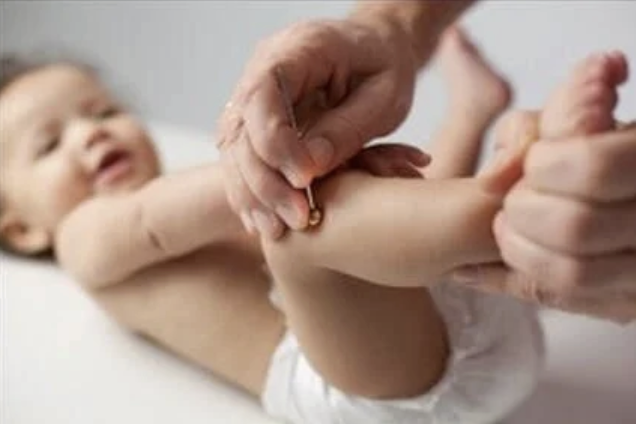 Infant receiving gentle acupressure or Tui Na treatment as part of pediatric TCM care in NW Calgary