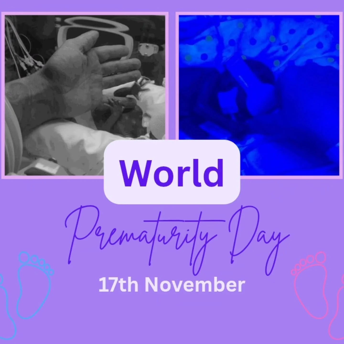 Where it all began! 5 months in hospital 446g &amp; 554g. The reason My Sen Den started...right here at 23 weeks...they'll be 10 on Sunday.
Behind everything we do is a story, a reason &amp; an understanding. Remembering today all the babies that can