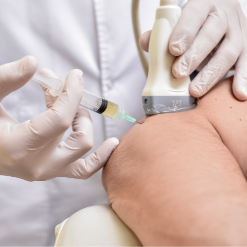 Ultrasound-Guided Regional Anesthesia: Enhancing Pain Management in Surgical Settings