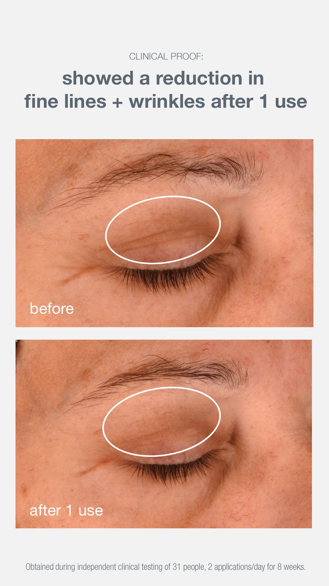 Phyto Nature Eye Cream_BA_claim_1 9x16BA 1 use.jpg