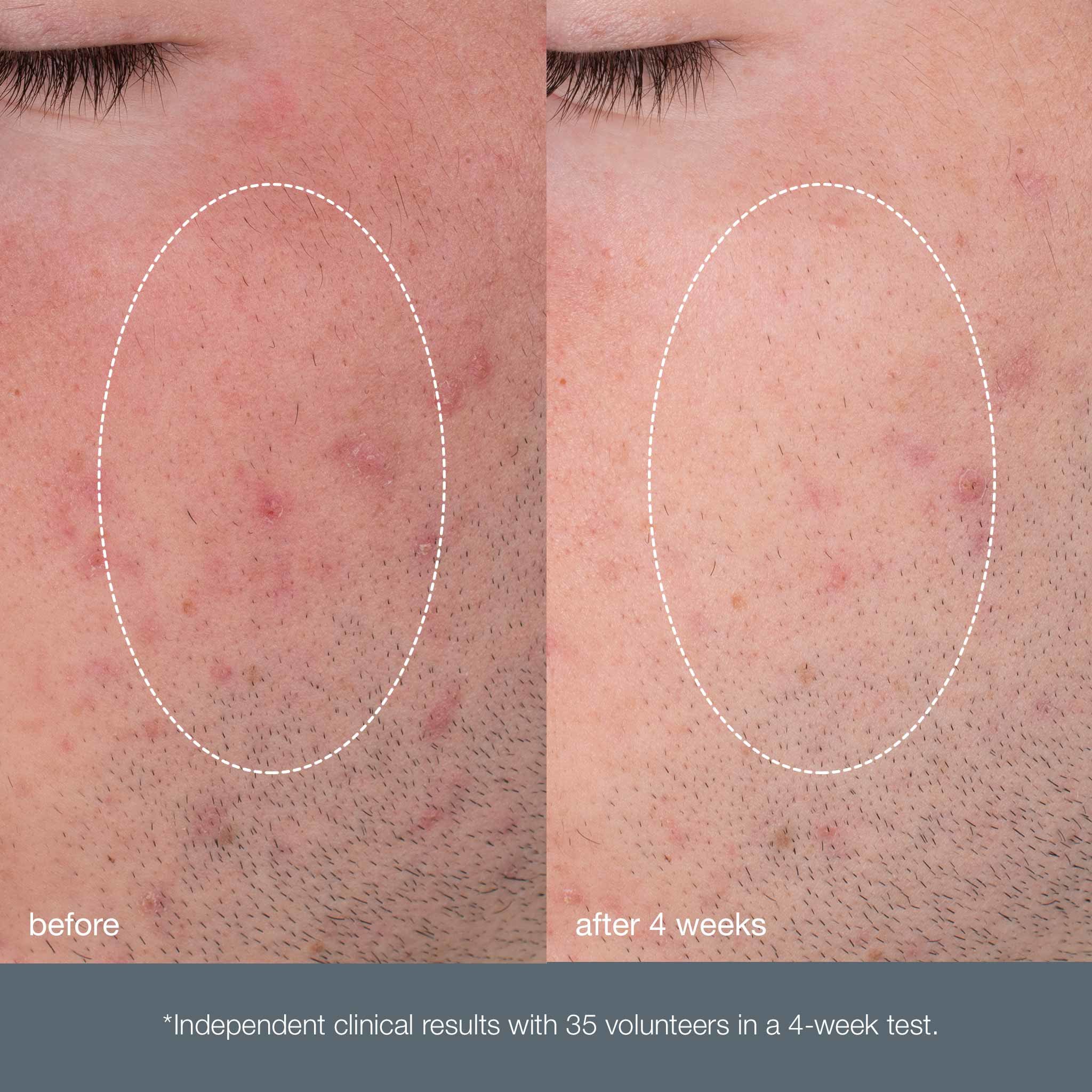 daily-microfoliant_b&a.jpg
