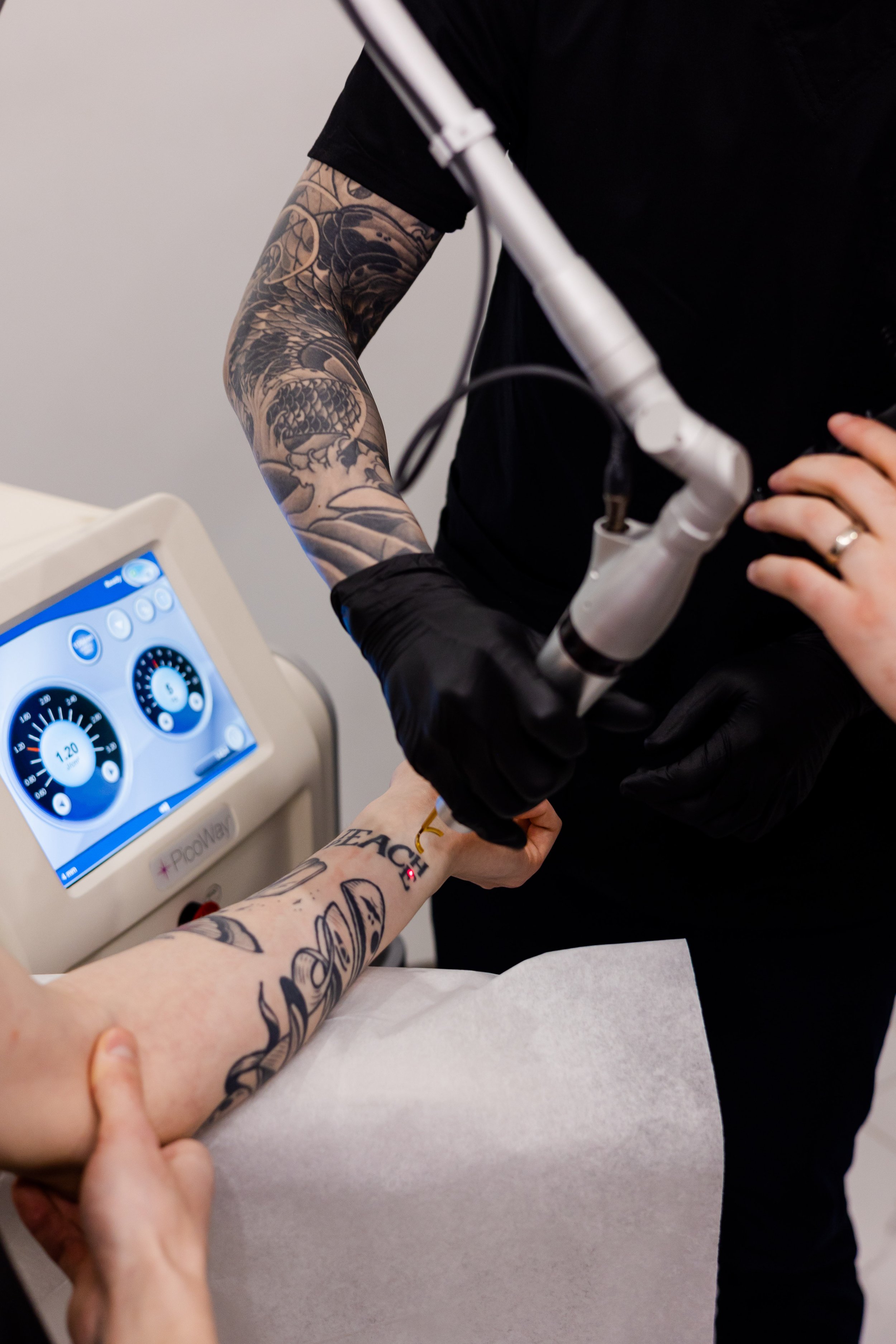The Top 5 Tattoo Removal Clinics in Edmonton 2023 