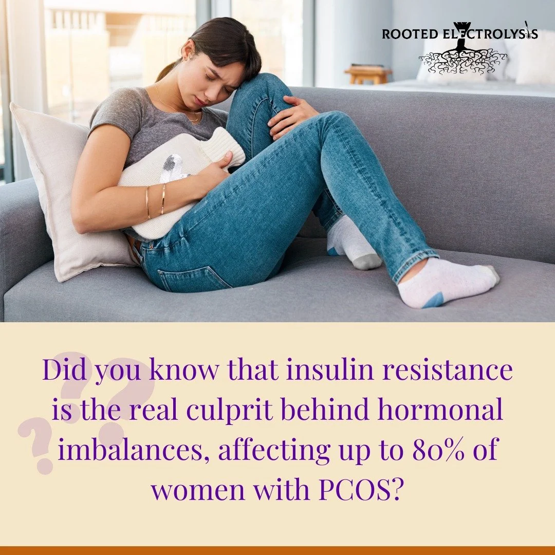 Tackling PCOS &amp; Unwanted Hair Growth 

One of the most frustrating symptoms for women with PCOS is unwanted hair growth, often driven by high testosterone levels. But the issue goes beyond the surface&mdash;insulin resistance is the real culprit 