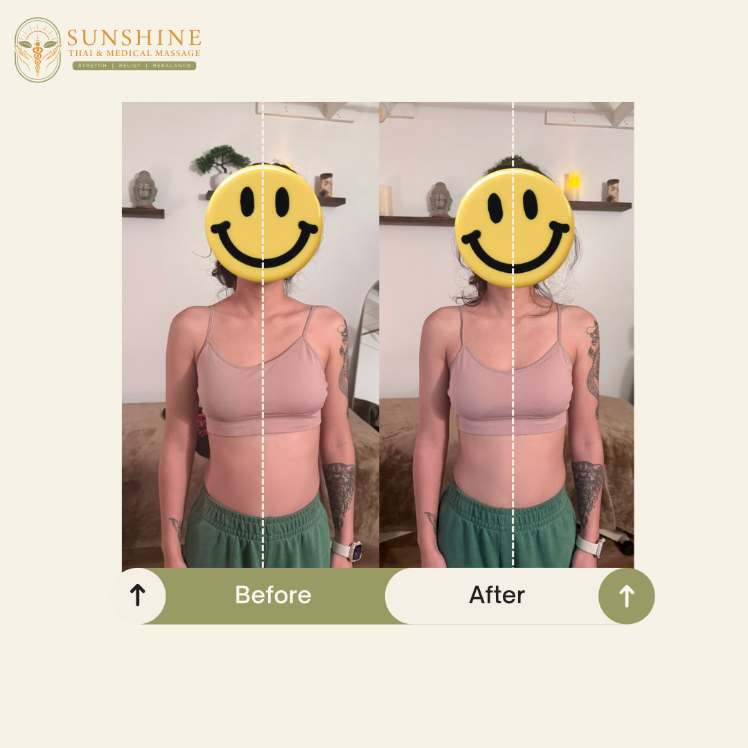 Before & After.png