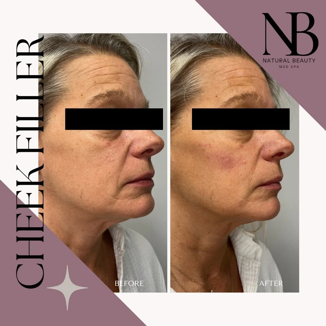 Copy of 02-Nurse-Injector-Posts - 47.JPG