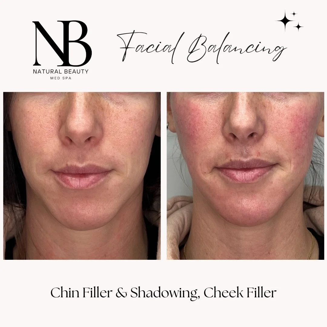 Copy of 02-Nurse-Injector-Posts - 119.JPG