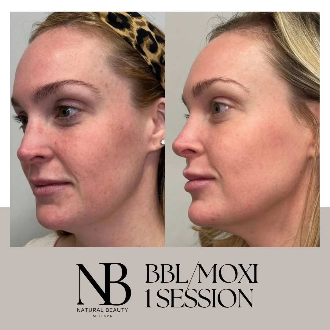 Copy of 02-Nurse-Injector-Posts - 89.JPG