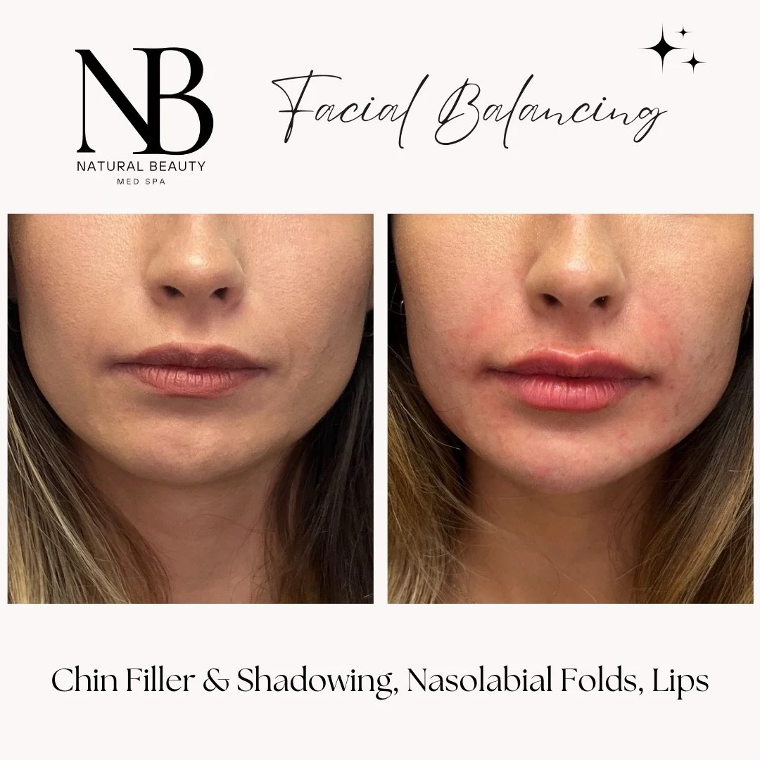 Copy of 02-Nurse-Injector-Posts - 116.JPG