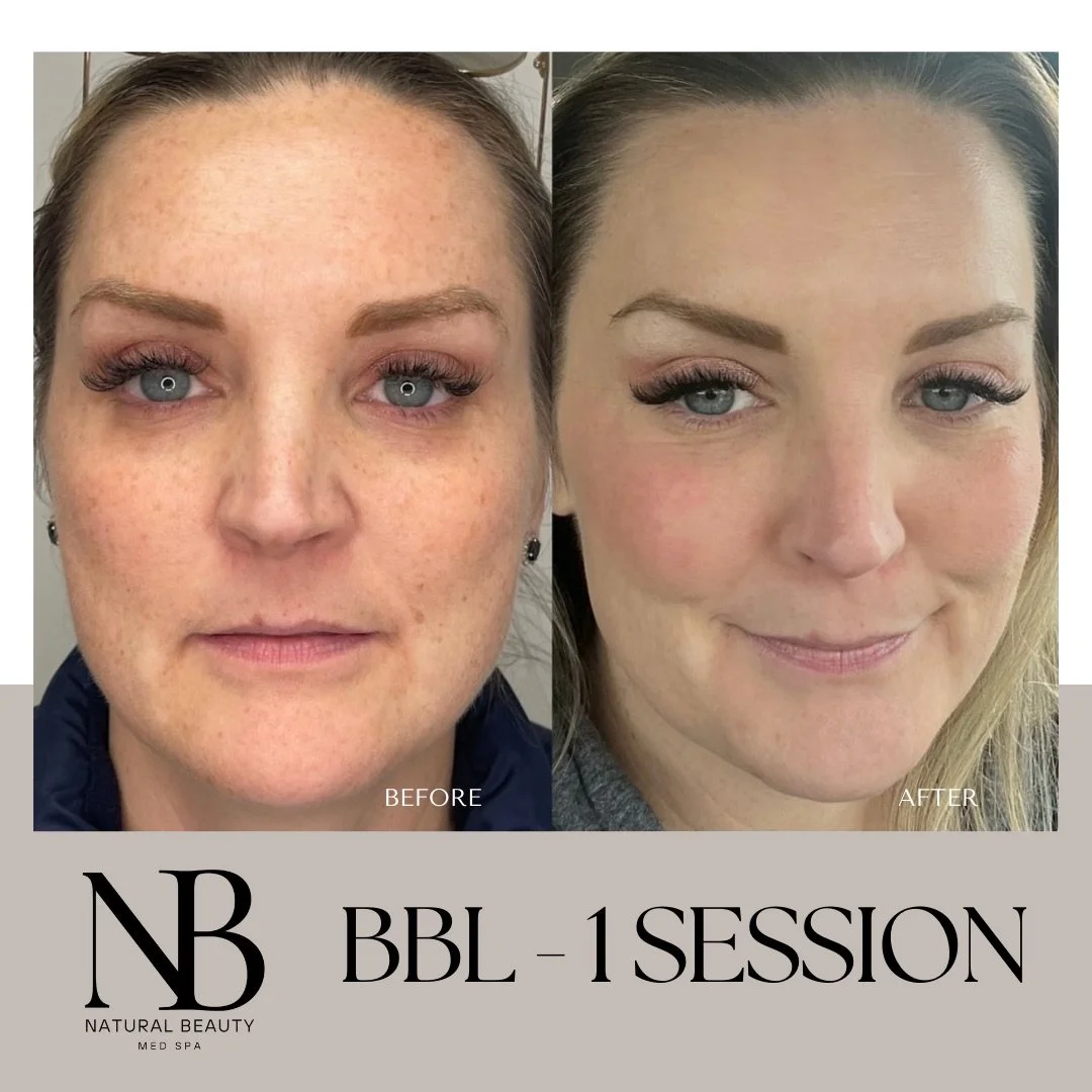 Copy of 02-Nurse-Injector-Posts - 90.JPG