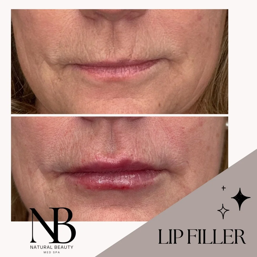 Copy of 02-Nurse-Injector-Posts - 72.JPG