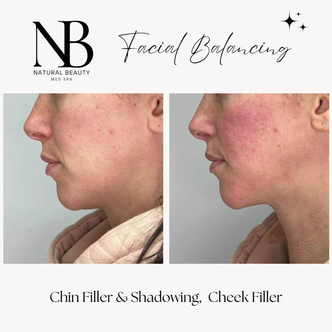 Copy of 02-Nurse-Injector-Posts - 117.JPG