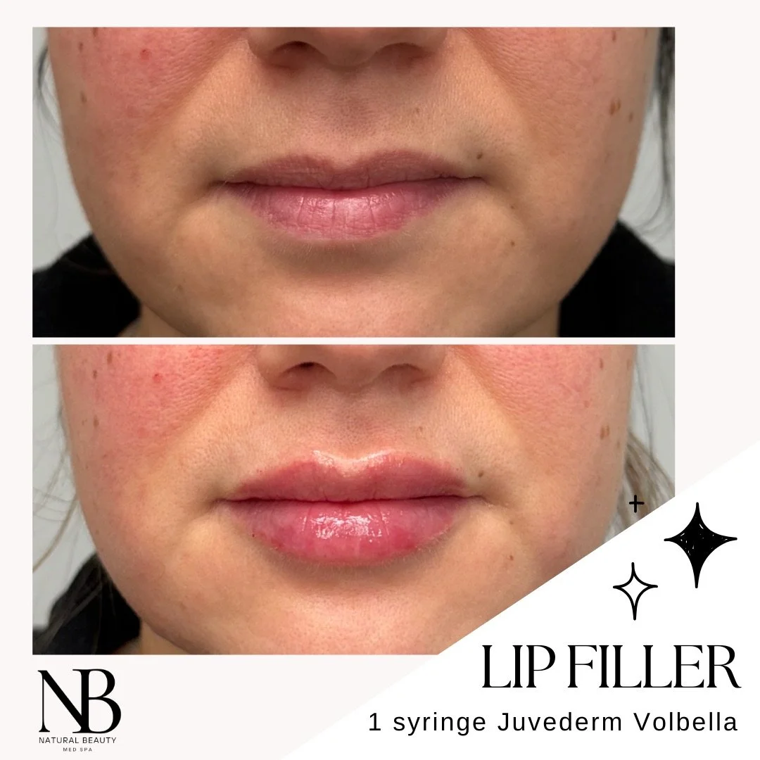 Copy of 02-Nurse-Injector-Posts - 56.JPG