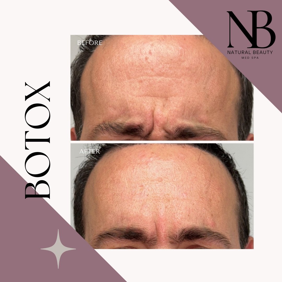 Copy of 02-Nurse-Injector-Posts - 37.JPG