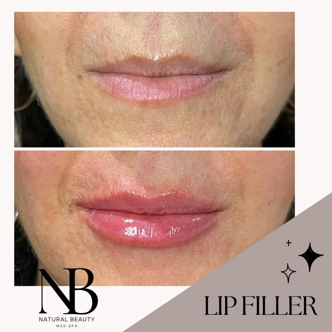 Copy of 02-Nurse-Injector-Posts - 71.JPG