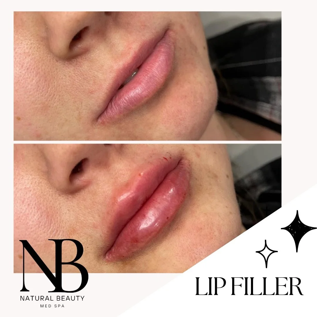 Copy of 02-Nurse-Injector-Posts - 65.JPG