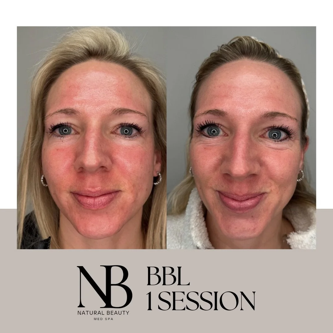 Copy of 02-Nurse-Injector-Posts - 84.JPG