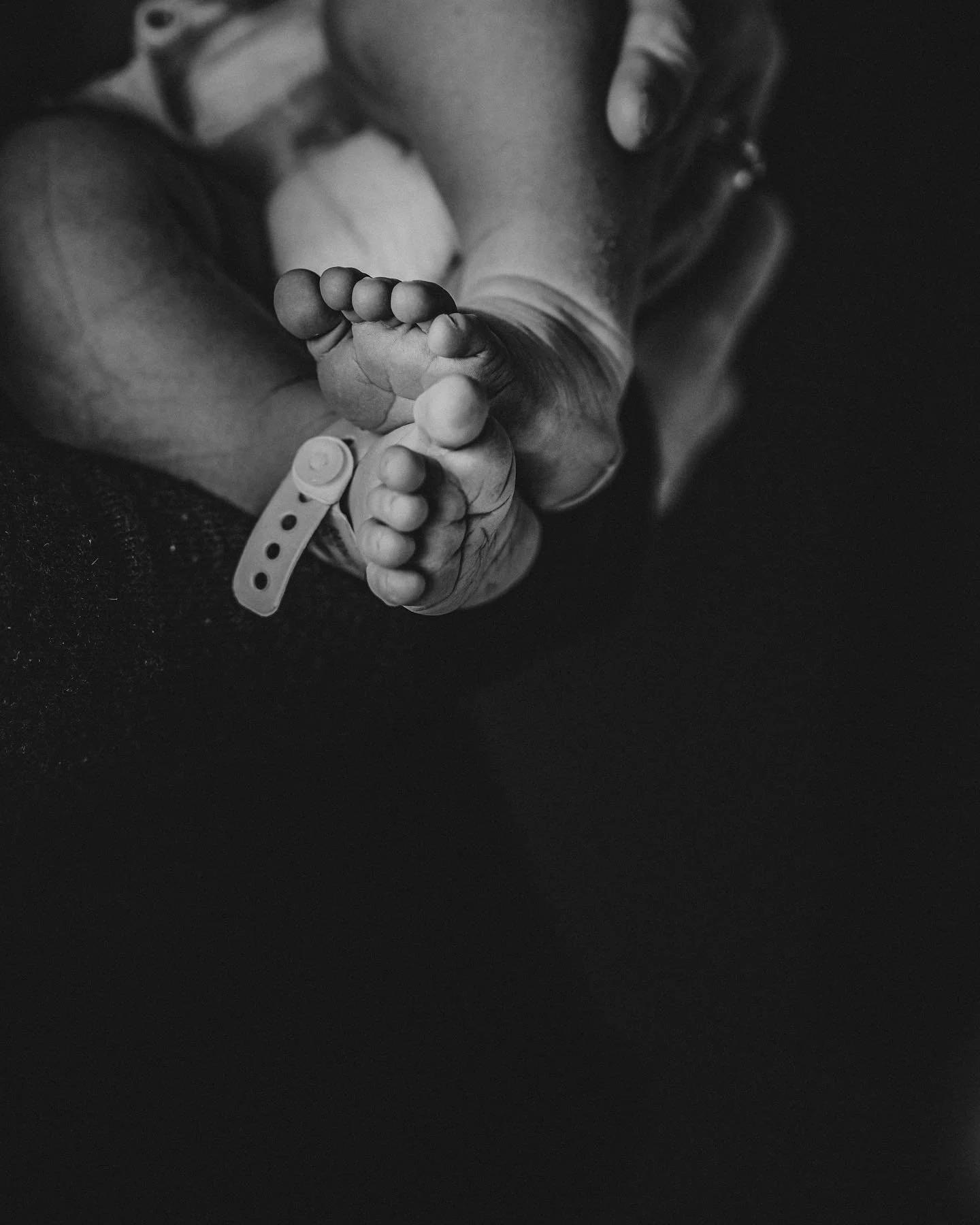 Black and white photo a newborn baby at toronto western hospital