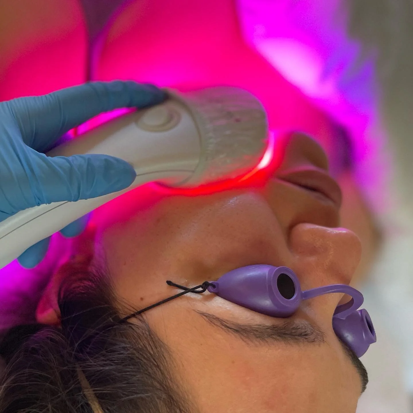 Where relaxation meets results 🤝

#healthyskin #ledlights #lightstim #acnetreatment #acnetips #pebblebeachfacialist #montereyfacials #montereybayfacials #pacificgrovefacials