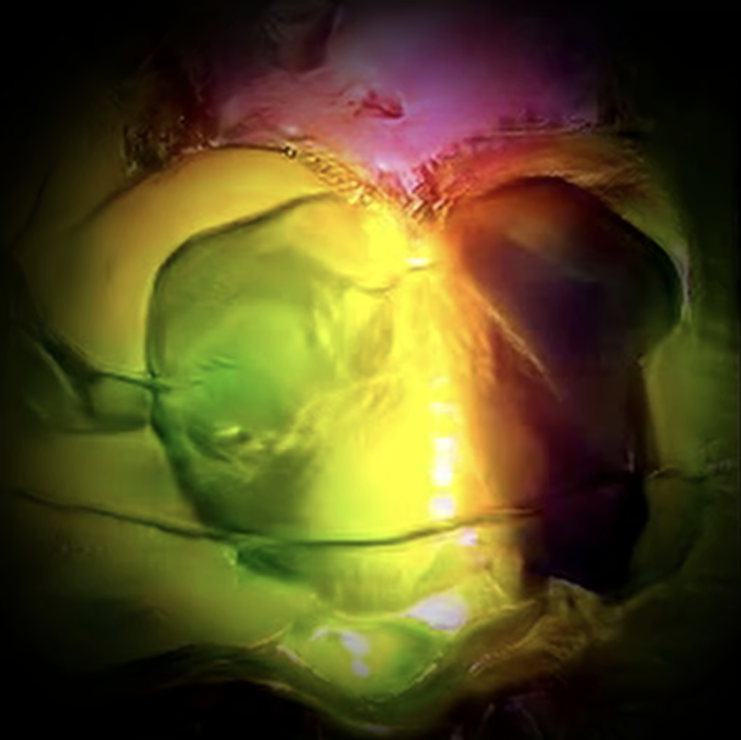 "Freedom Begins with Breakfast"  |  Wind Up Radio  |  2026