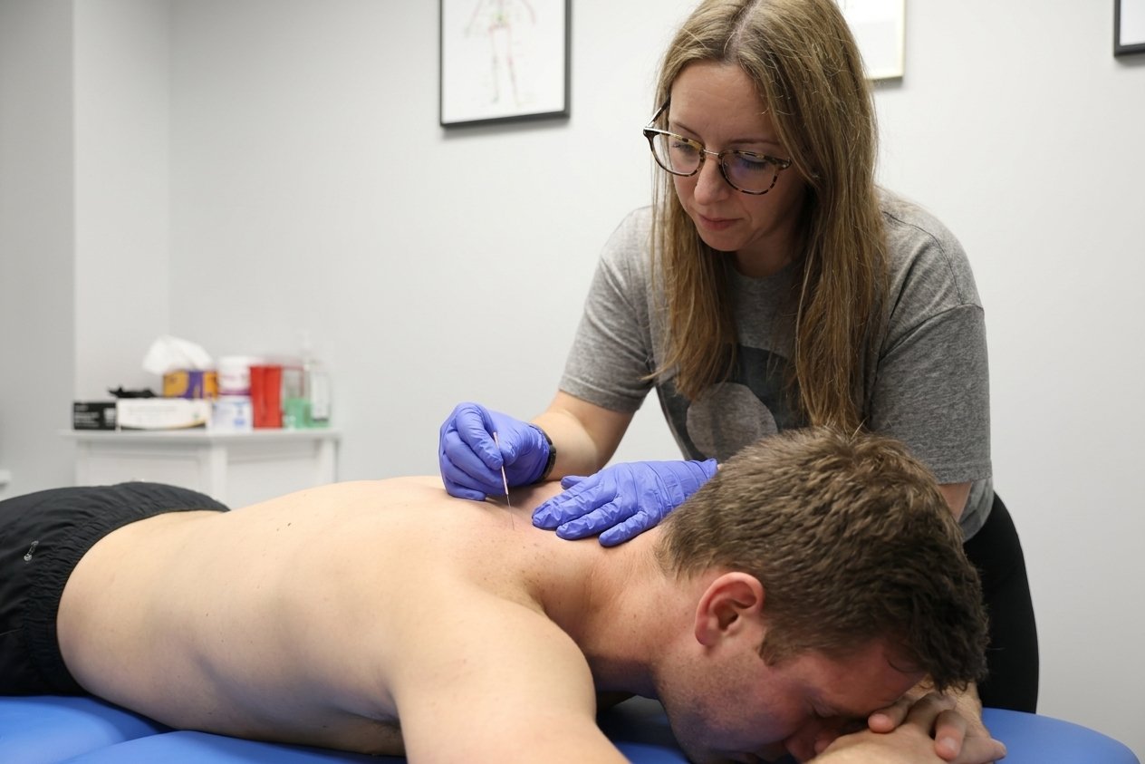 Patient working with a provider at a sports physical therapy clinic in Bryn Mawr, PA receiving dry needling treatment for shoulder pain
