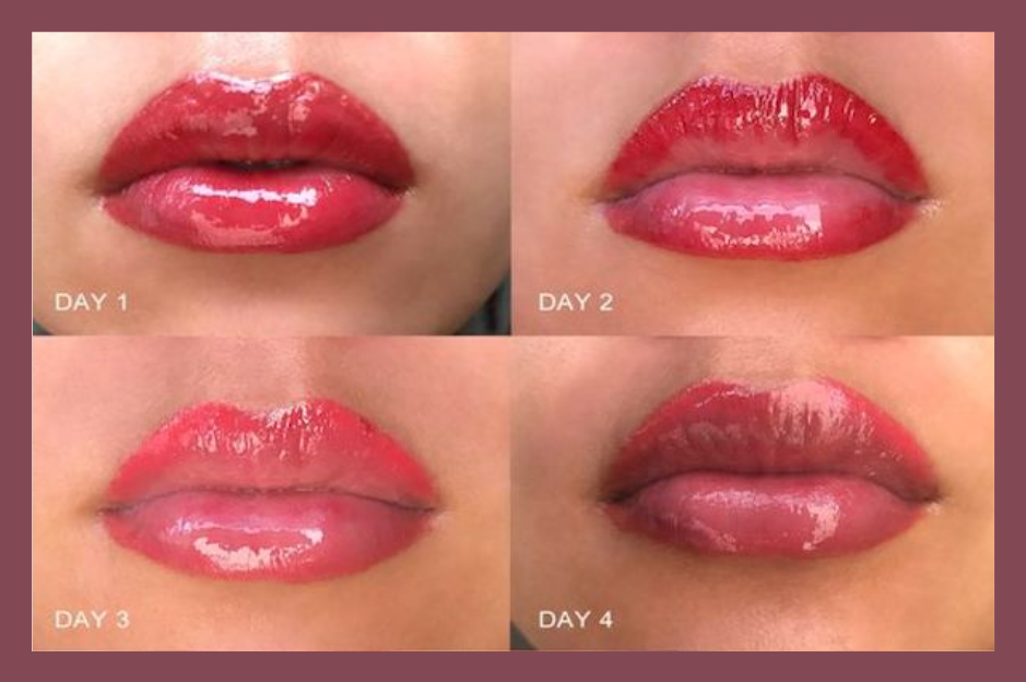 LIP TATTOO HEALING PROCESS…….. many have ask us for photos of what lips go  through during healing stages.. 👄👄👄Recorded by im... | Instagram