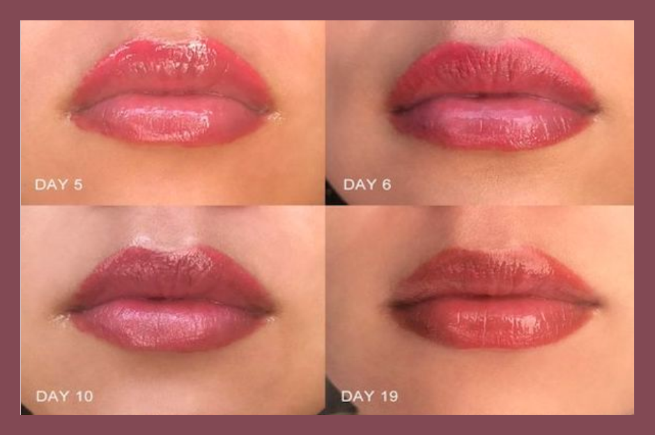 Permanent Makeup Lips Healing