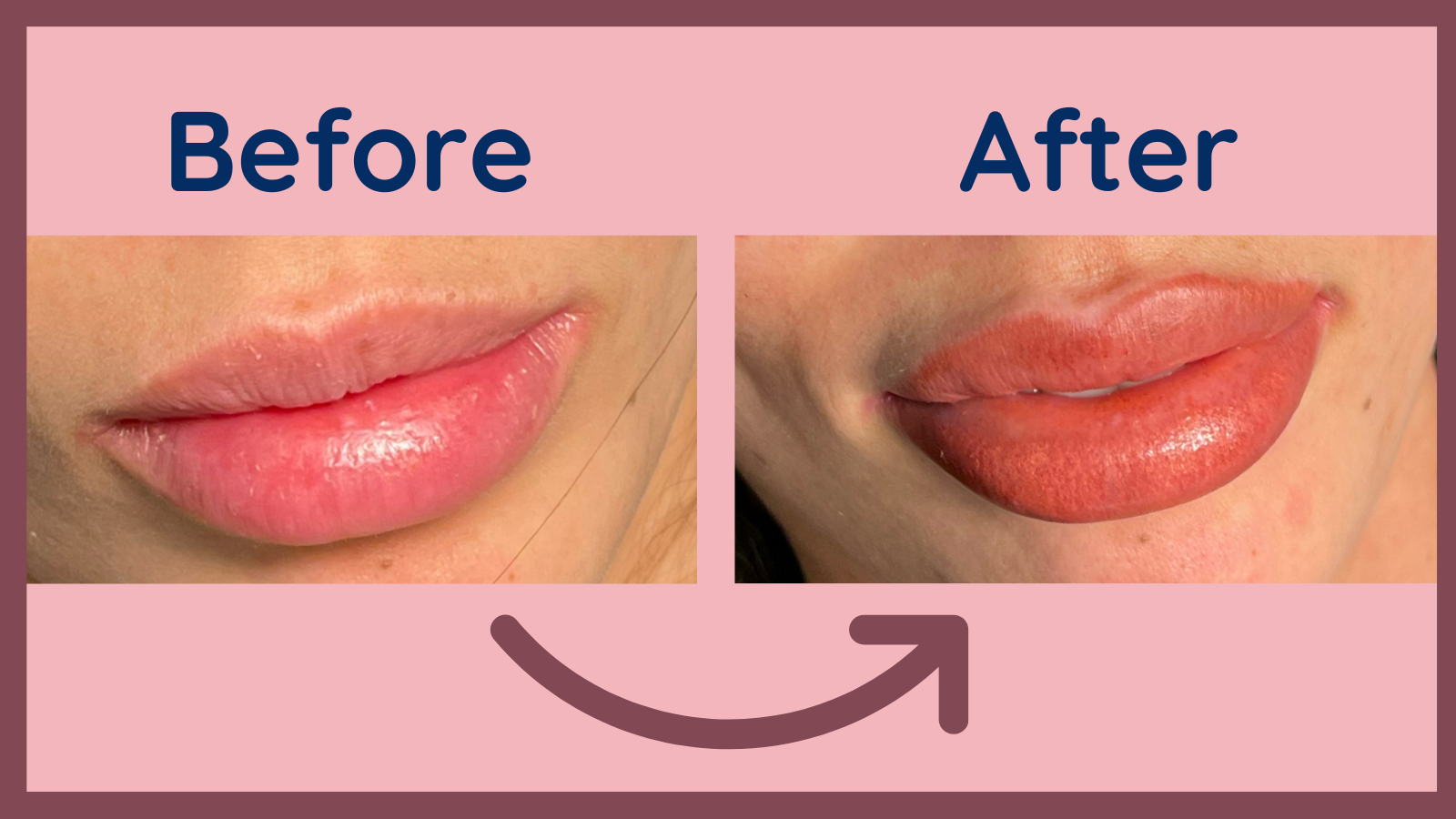 Lip tattoo: pros and cons, types of permanent lip makeup - Elite Look