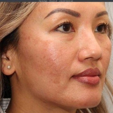 Topical Skin Care