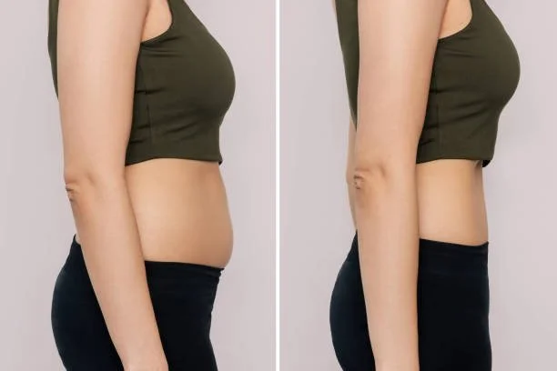 Weight loss management