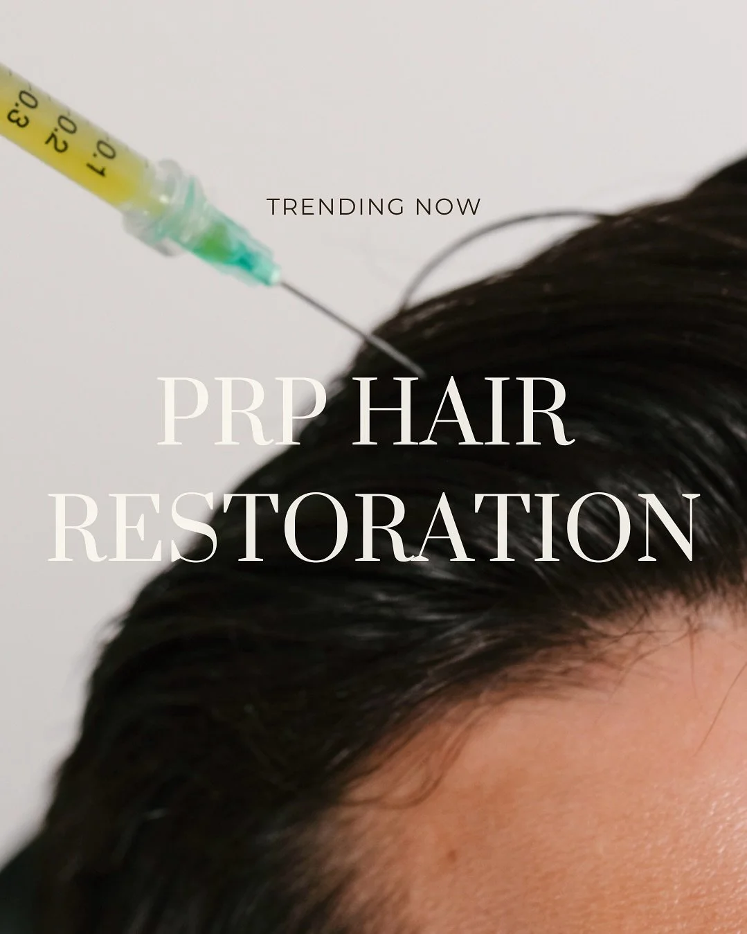 ✨ PRP Hair Restoration ✨

PRP is a natural, non-surgical treatment that helps restore hair growth by harnessing the regenerative power of your own platelets 🧬. By increasing blood flow to the hair follicles, PRP stimulates growth, improves hair thic