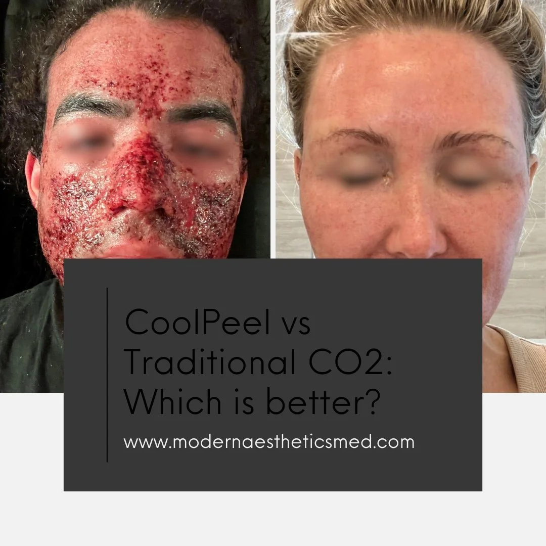 CoolPeel vs Traditional CO₂ Laser in San Jose, CA